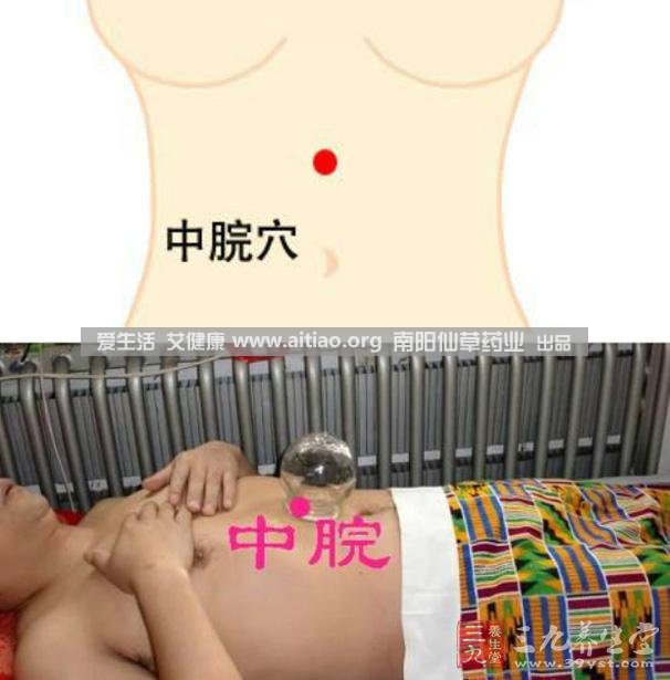 中脘穴位于腹部正中線(xiàn)，臍上4寸的位置上。每天艾灸10-15分鐘，能有效緩解胃部不適的癥狀，同時(shí)有助于祛濕。